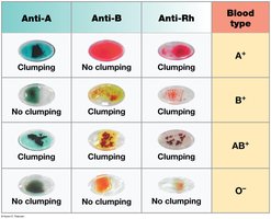Blood type testing with anti-A, anti-B, and anti-Rh antibodies