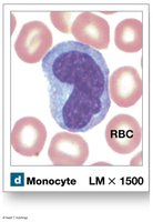 Monocyte (agranular leukocyte)