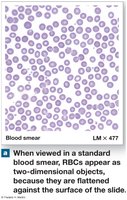 Blood smear showing two-dimensional RBCs