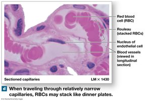 RBCs stacked as rouleaux in capillaries