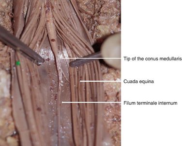 Dissection showing conus medullaris, cauda equina, and filum terminale