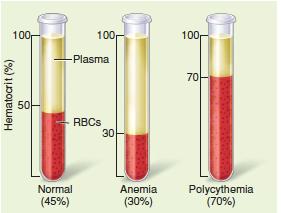 Hematocrit tubes: normal, anemia, polycythemia