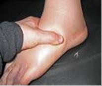 Pitting edema demonstration