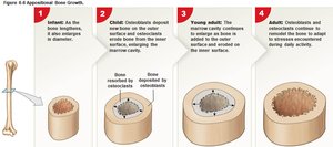 Appositional bone growth