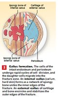 Step 2: Callus formation