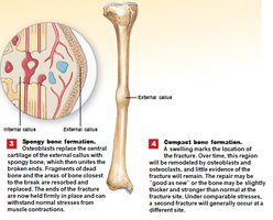 Steps 3-4: Spongy bone and compact bone formation
