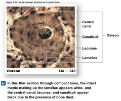 Microscopic structure of compact bone: osteon, central canal, canaliculi, lacunae, lamellae
