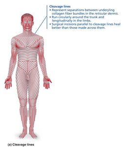 Cleavage lines in the skin