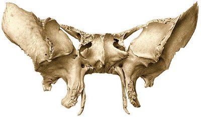 Sphenoid bone with labeled body, wings, and foramina