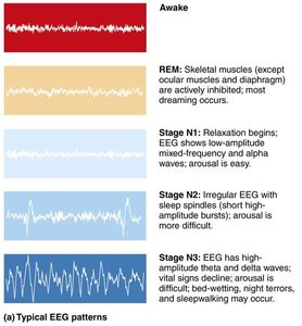 Typical progression of an adult through one night's sleep stages