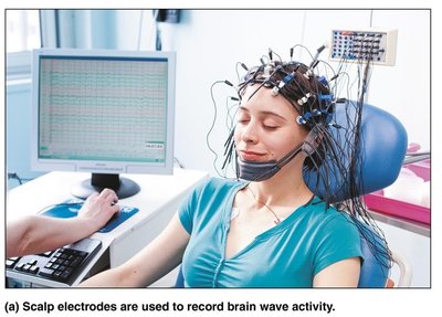 Scalp electrodes used to record brain wave activity