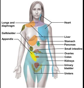 Diagram of referred pain areas