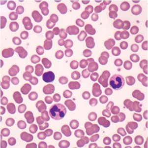 Normal blood smear