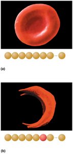 Normal vs. sickled erythrocyte
