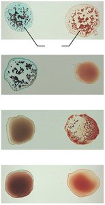 Blood typing of ABO blood types