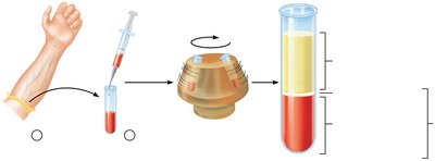Blood centrifugation showing plasma, buffy coat, and erythrocytes