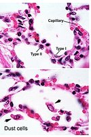 Alveolar cell types and dust cells