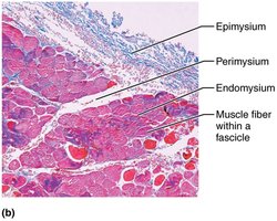 Photomicrograph showing epimysium, perimysium, and endomysium