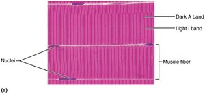 Photomicrograph showing striations in skeletal muscle fibers