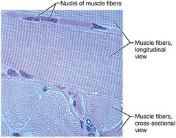 Photomicrograph of muscle fibers in longitudinal and cross section