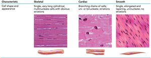 Cell shape and appearance of muscle types