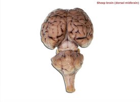 Sheep brain, dorsal midbrain