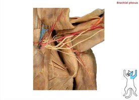 Brachial plexus dissection