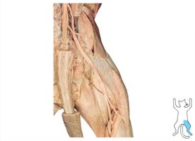 Sacral plexus dissection