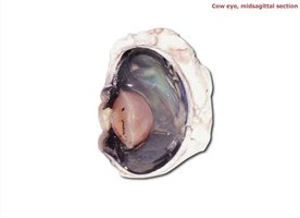Cow eye, midsagittal section