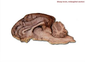 Sheep brain, midsagittal section showing internal structures