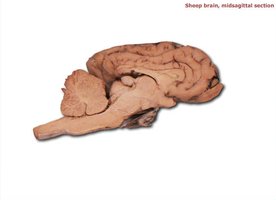 Sheep brain, midsagittal section showing thalamus, hypothalamus, and cerebellum