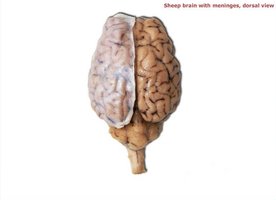 Sheep brain with meninges, dorsal view
