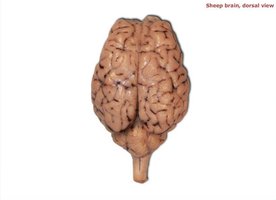 Sheep brain, dorsal view