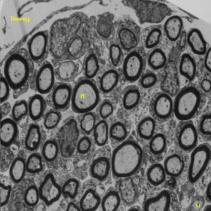Schwann cells electron micrograph