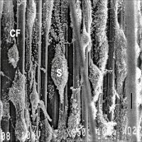 Schwann cells SEM