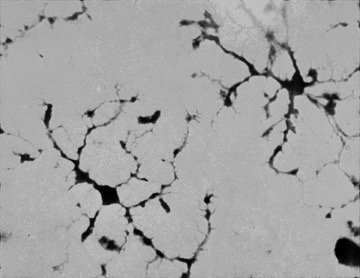Microglia histology