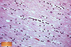 Oligodendrocytes histology