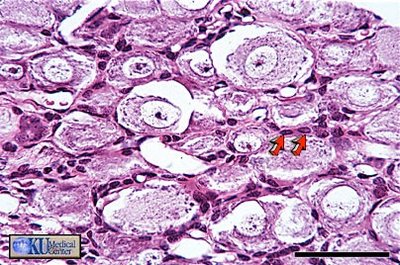 Satellite cells histology