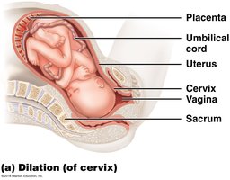 Dilation stage of labor