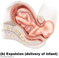 Expulsion stage of labor