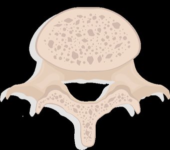 Irregular bone cross-section