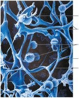 Reticular connective tissue in a human lymph node