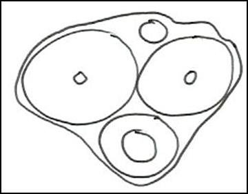 Detailed cross-section of the penis highlighting the corpora cavernosa and corpus spongiosum