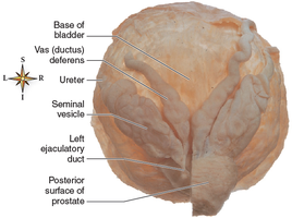 Dissection showing male accessory glands: seminal vesicle, prostate, vas deferens