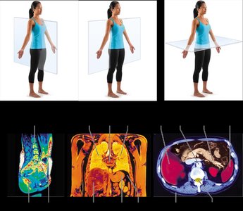 Body planes and MRI sections