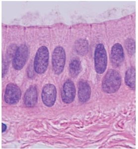 Stratified columnar epithelium under microscope