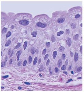 Transitional epithelium under microscope