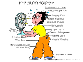 Symptoms and clinical features of hyperthyroidism