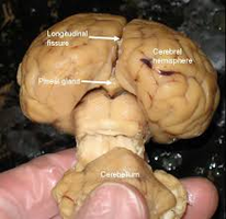 Pineal gland location in the brain