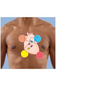 Areas on the thoracic surface where heart sounds are heard most clearly